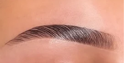 Browlifting